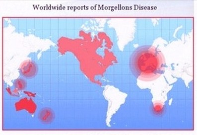 chemtrail-morgellons-map-small.jpg